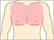 福井 Ｂ＆Ｂ メンズ脱毛 胸元全体｛乳輪周り込み｝